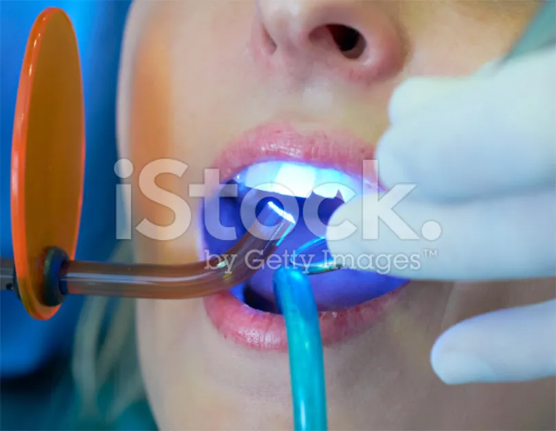 /img/33499-tooth-whitening-cost-irvine.webp