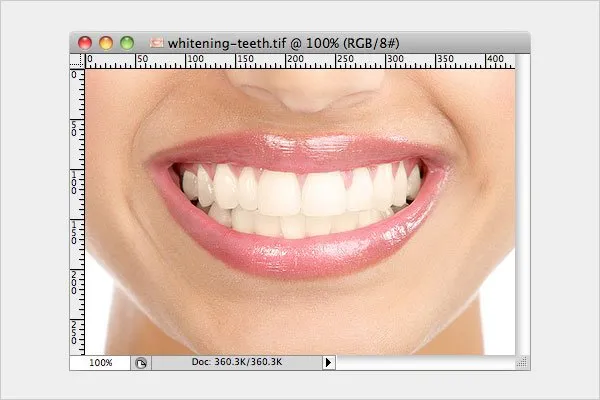 33500 teeth whitening photo editors 7