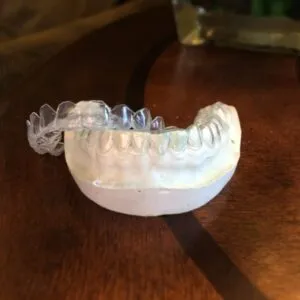 33504 teeth whitening new rochelle confidence