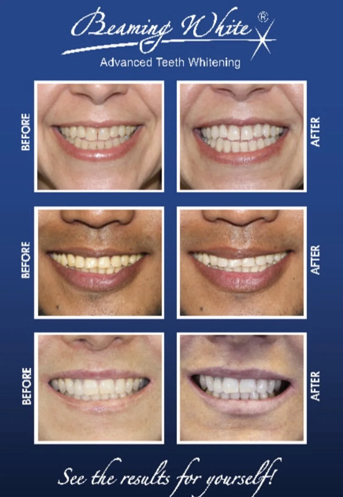 33504 teeth whitening new rochelle oral health