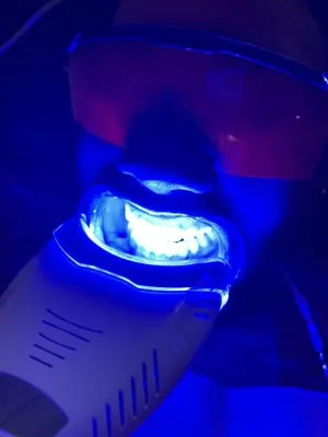 33507 teeth sensitivity treatment