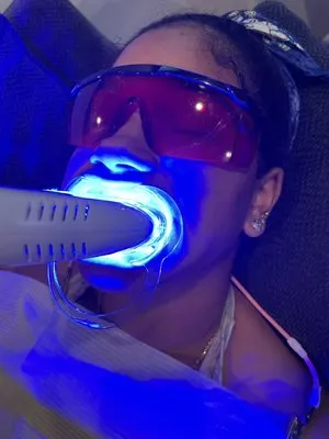 33507 teeth whitening strips