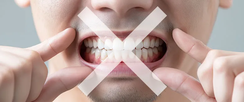 33510 in office whitening