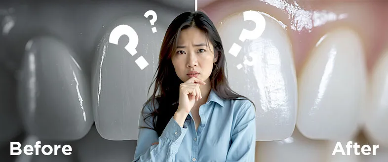 33510 whitening agents