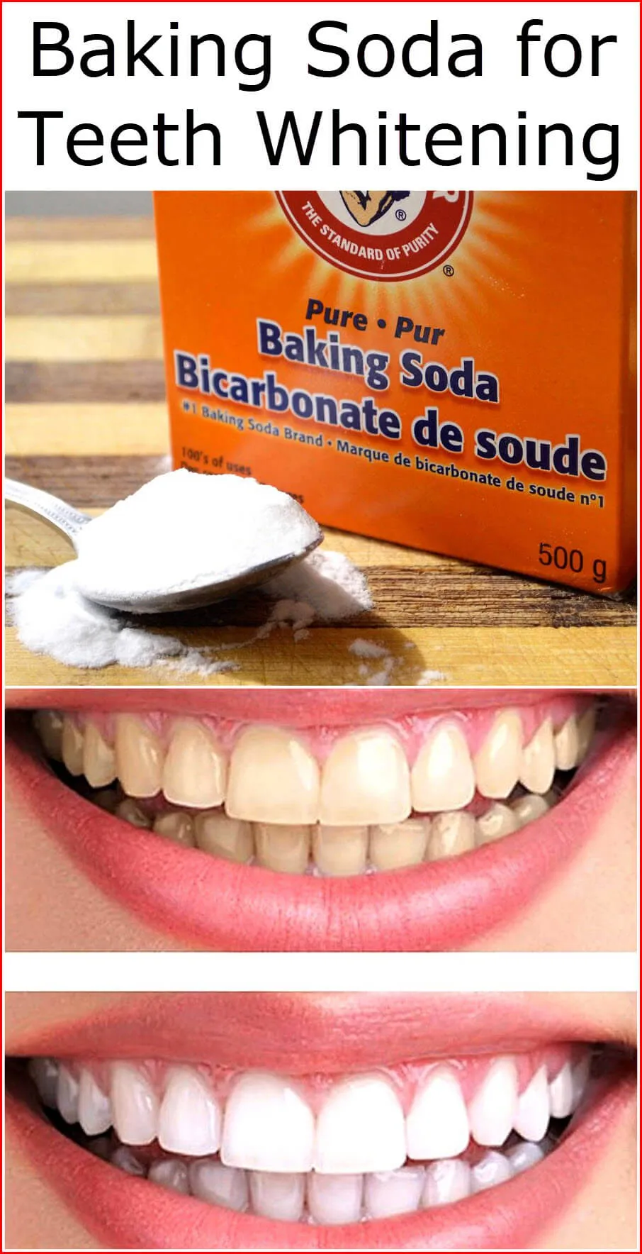 33514 baking soda teeth whitening