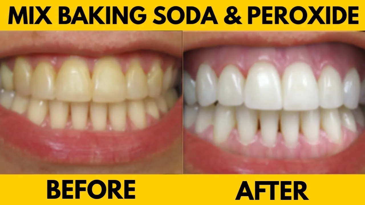 33514 healthy smile