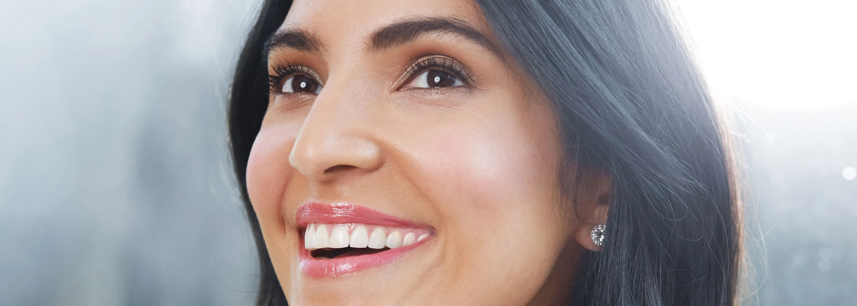 33520 professional teeth whitening