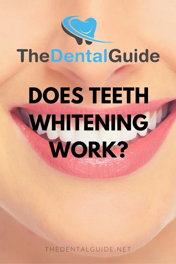 33532 dentist whitening process