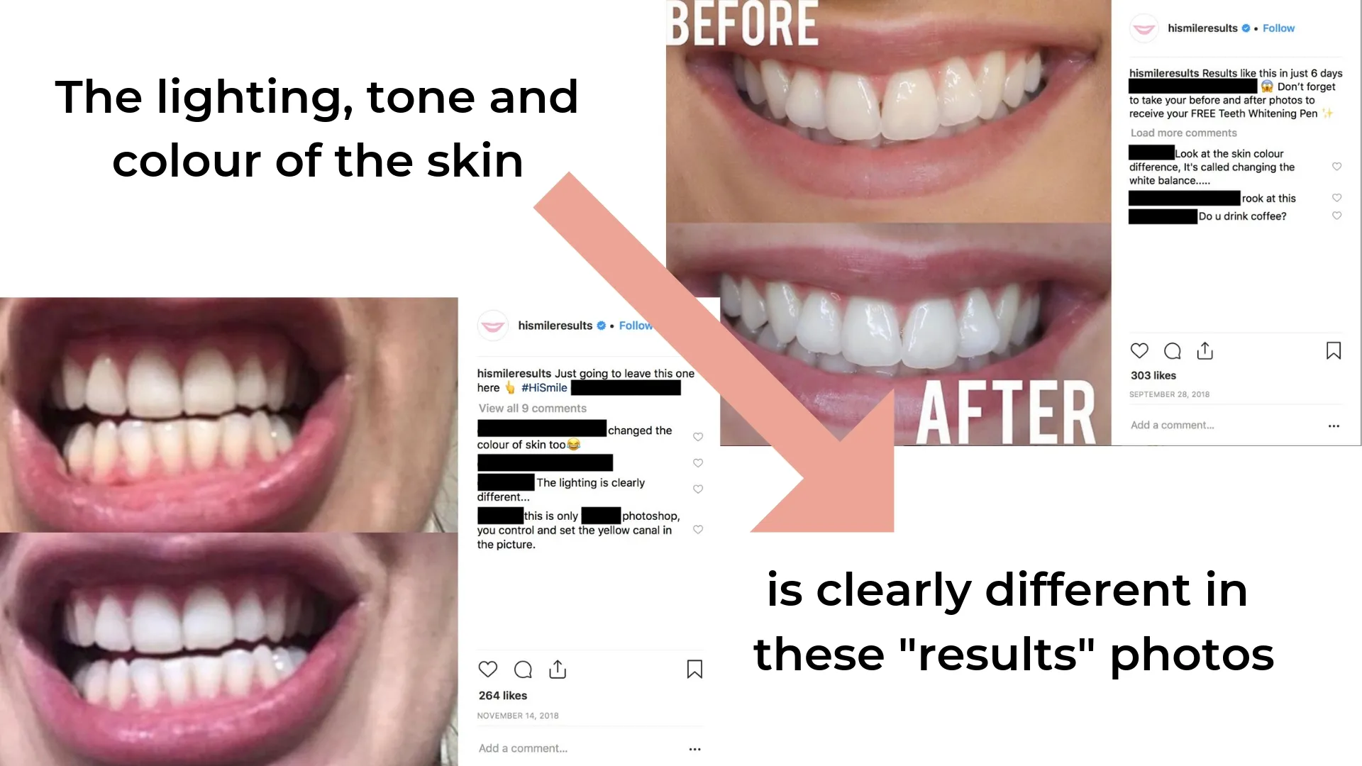 33534 hismile pen sensitivity