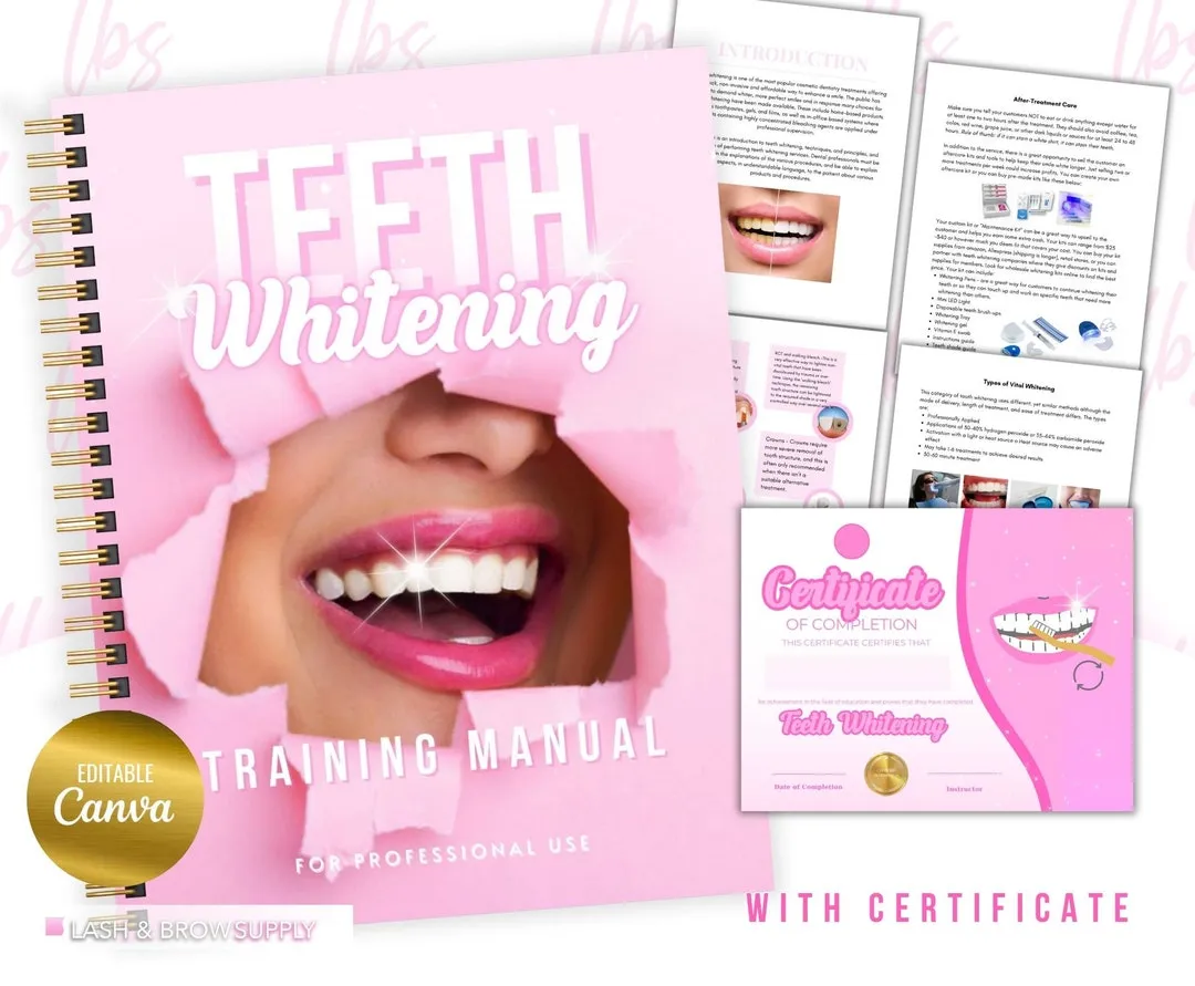 33560 teeth whitening job