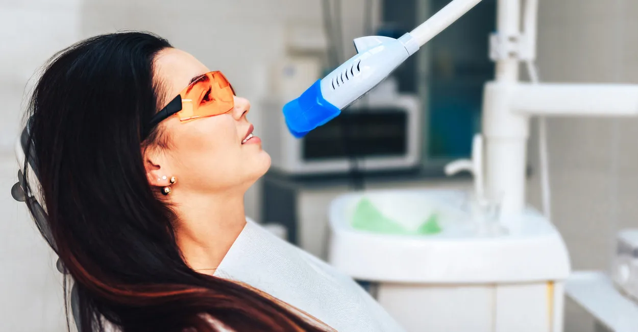 33565 in office teeth whitening