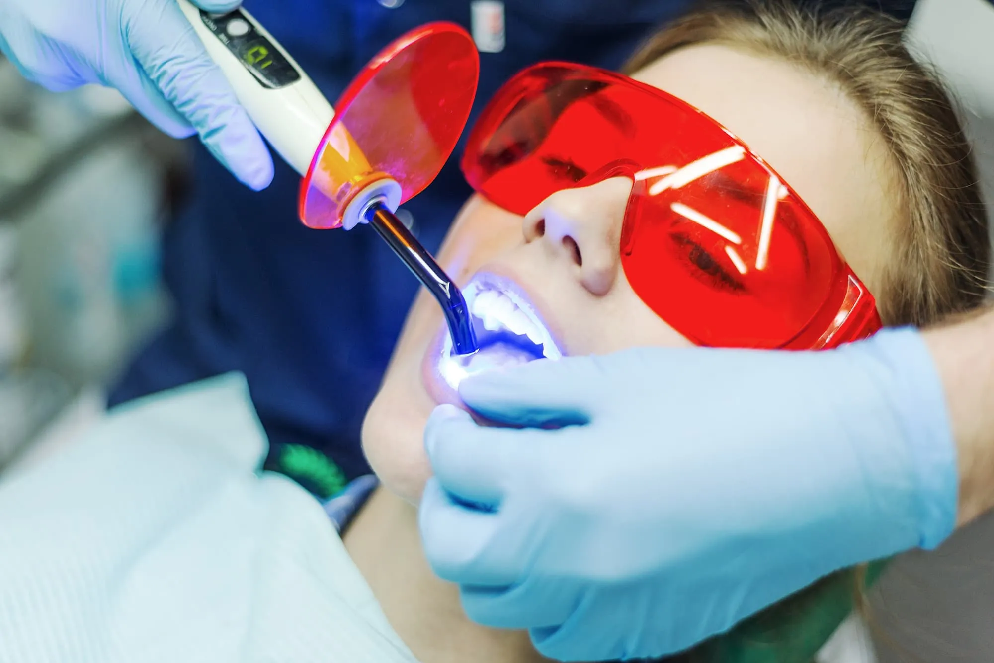 33570 cost of teeth whitening