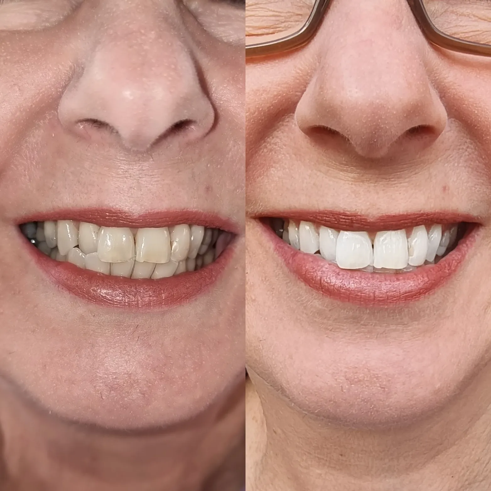 33570 professional dental consultation