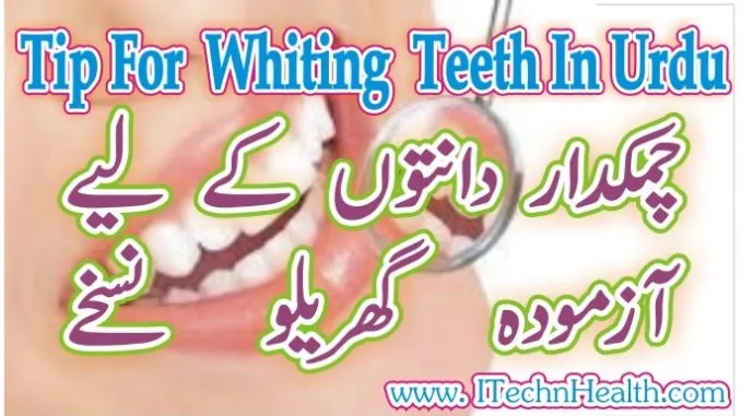 33581 whitening strips