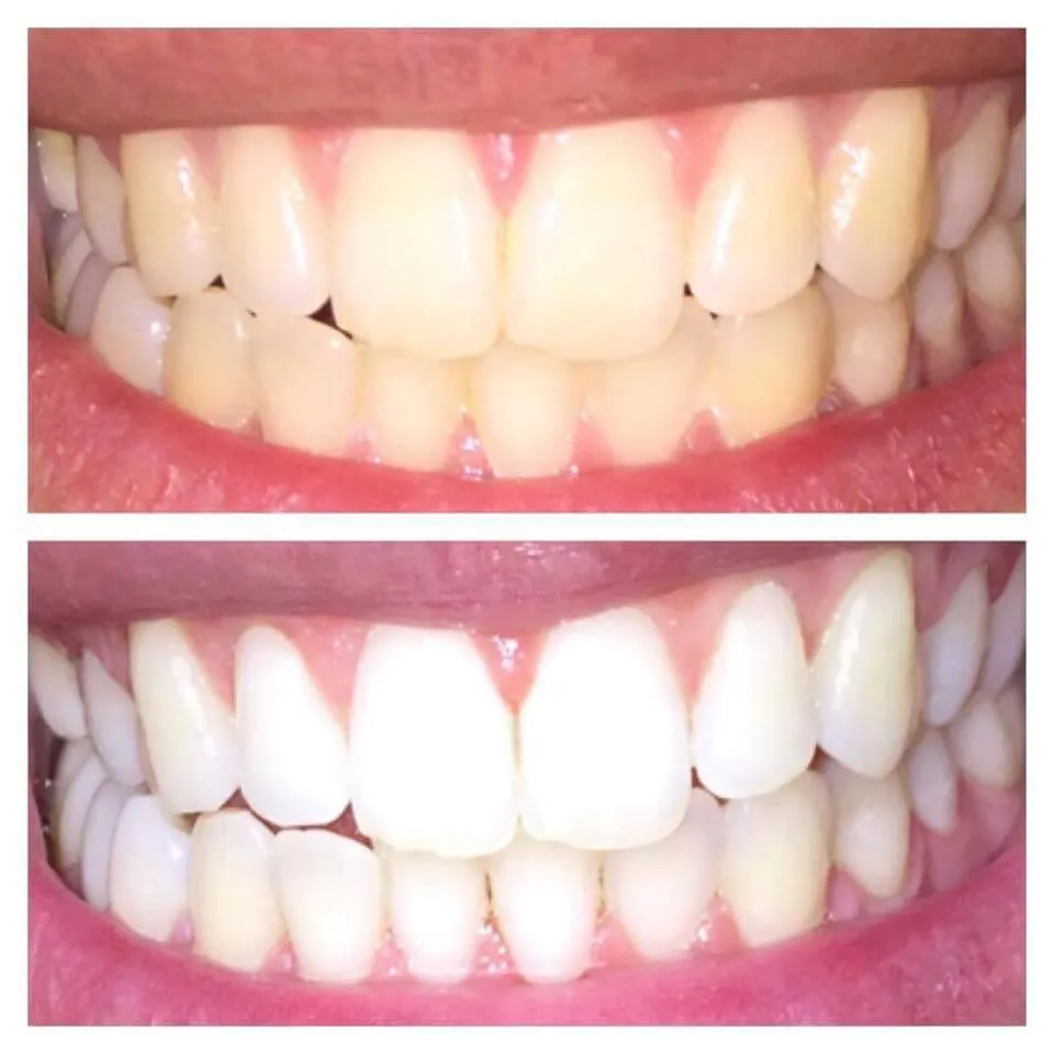 33587 difficulty breathing