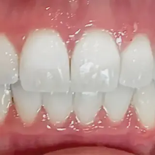 /img/33605-teeth-whitening-products.webp