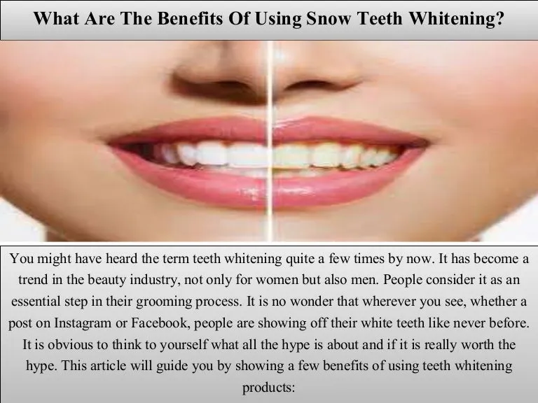 33615 snow teeth whitening ingredients