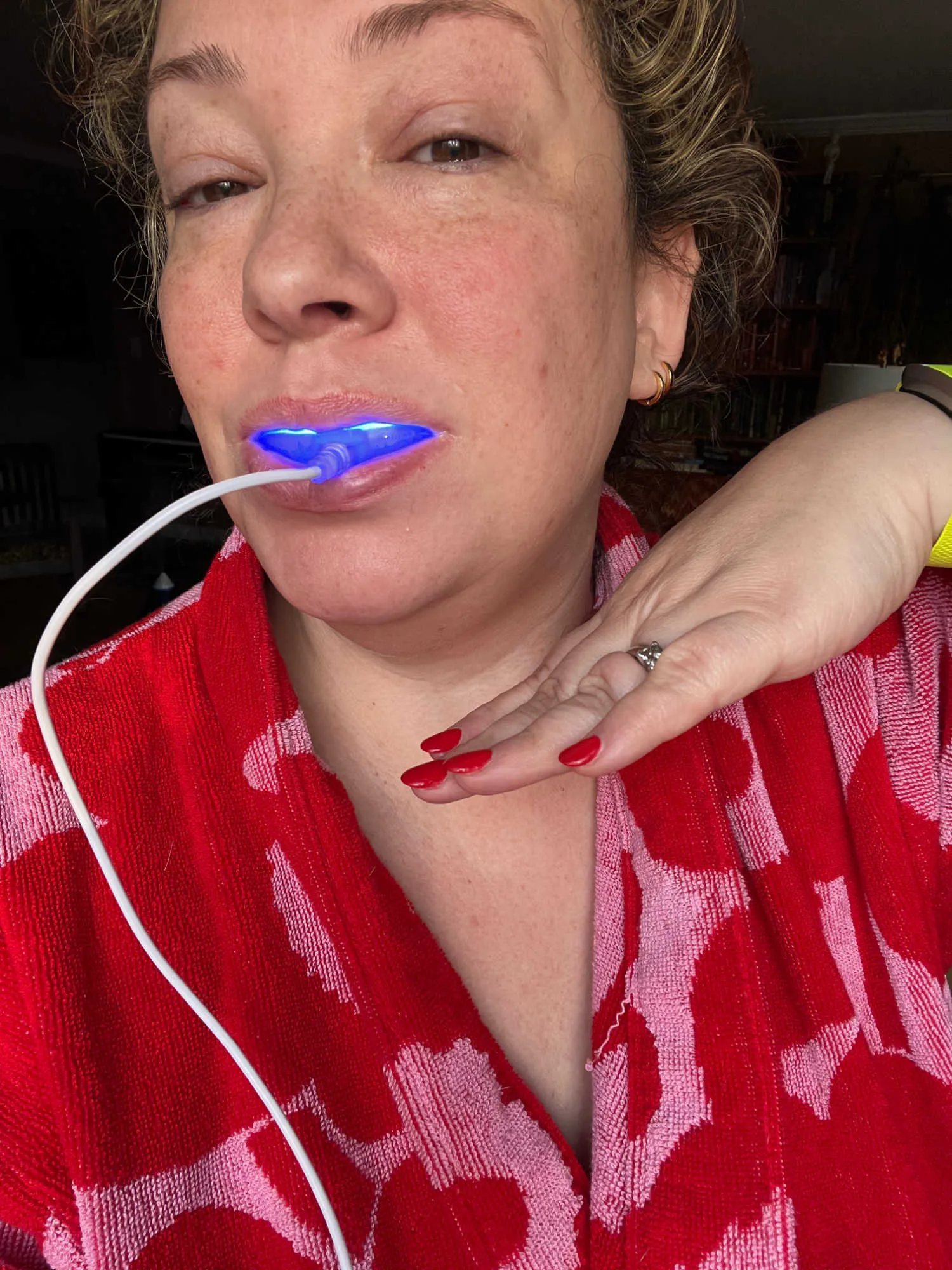 33615 snow teeth whitening user review