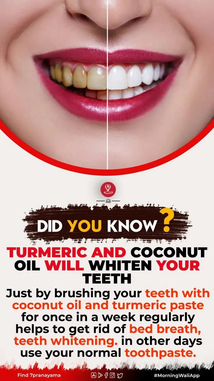 33618 turmeric coconut oil teeth whitening