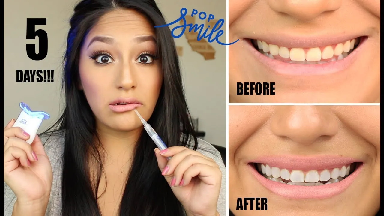 33625 easy smile teeth whitening diet