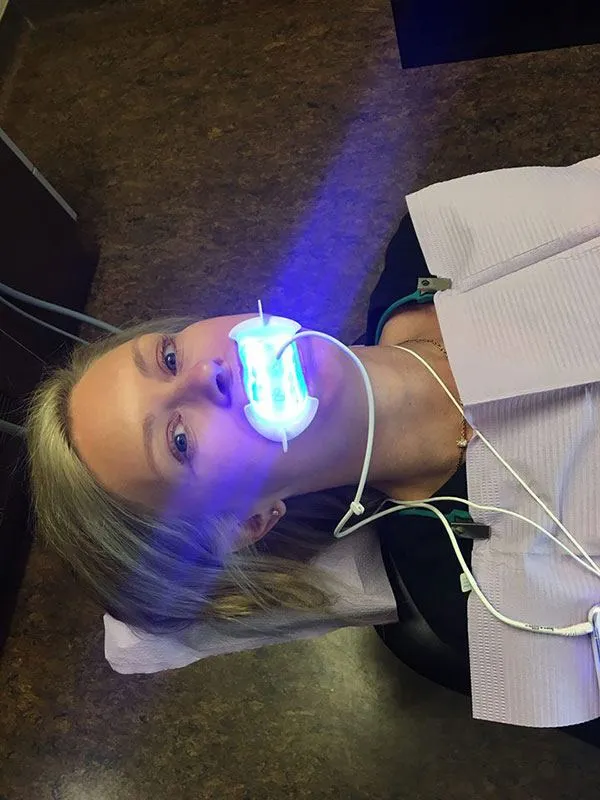 33638 oxygen teeth whitening methods