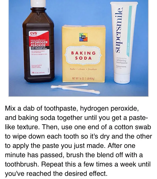 33647 white smile after teeth whitening