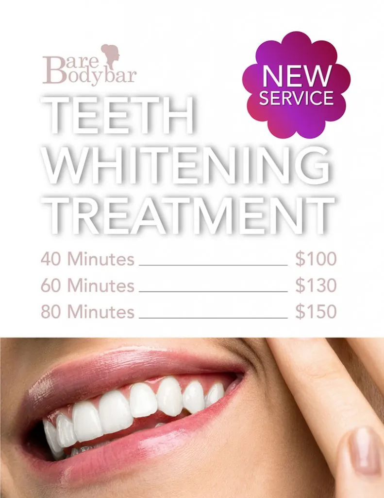 33651 at home whitening