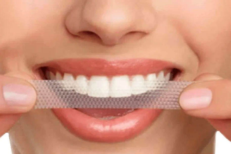 33663 applying whitening strips