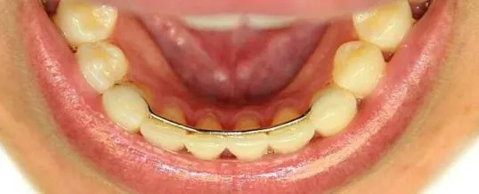 33667 whitening toothpaste