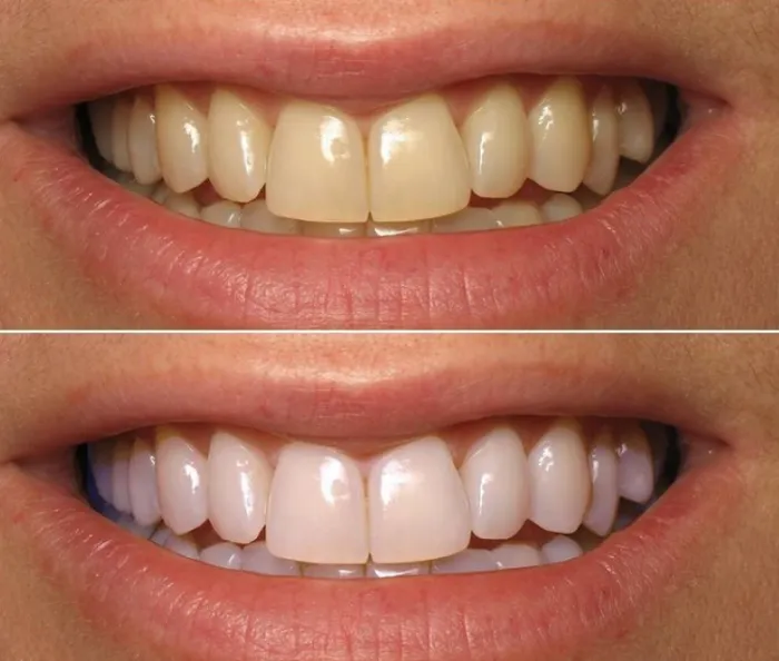33670 whitening strips ingredients