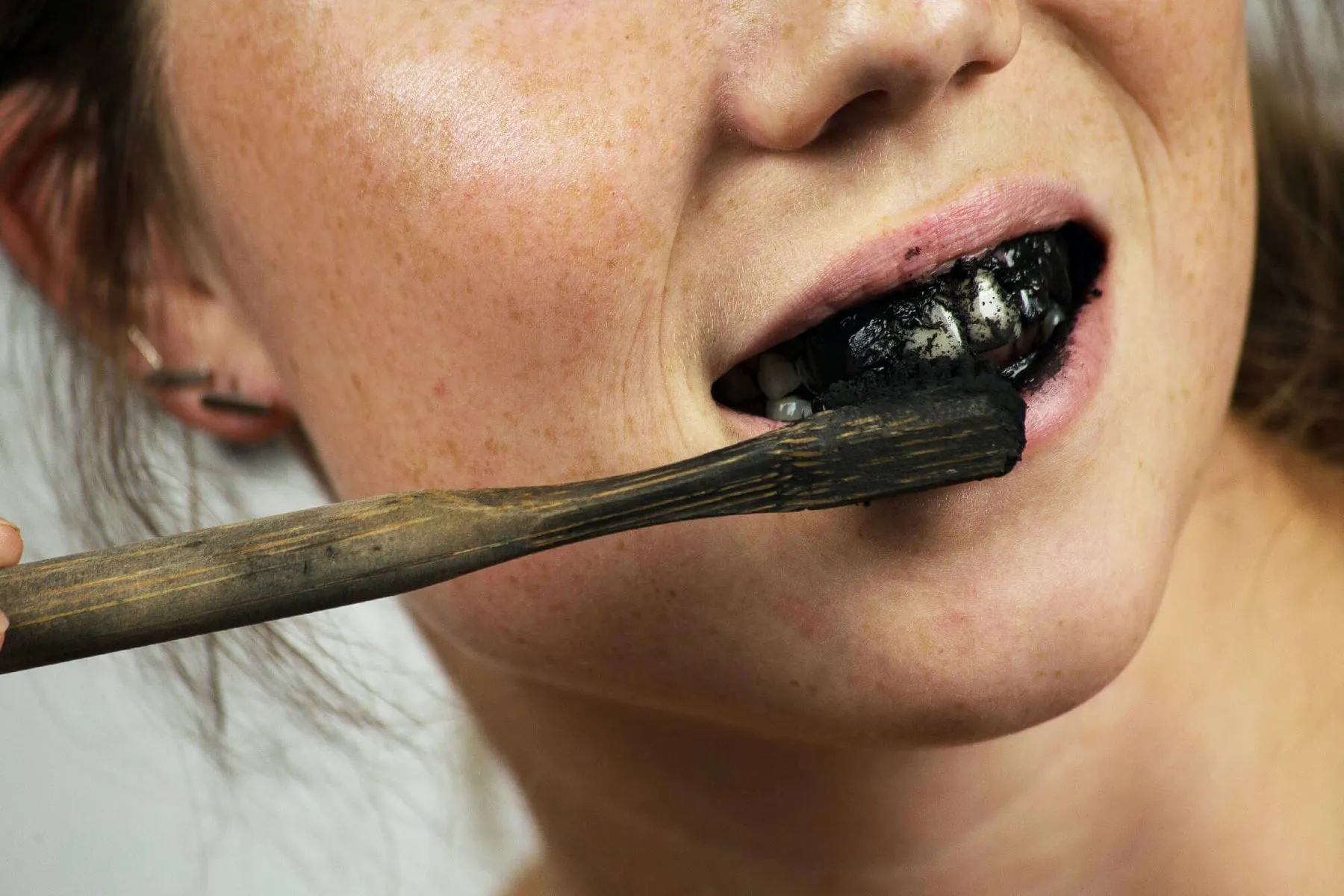 33697 teeth whitening results