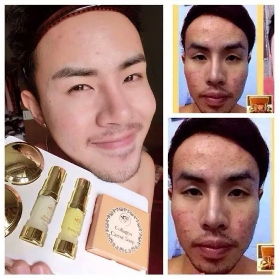 33702 whitening lotion thailand 1