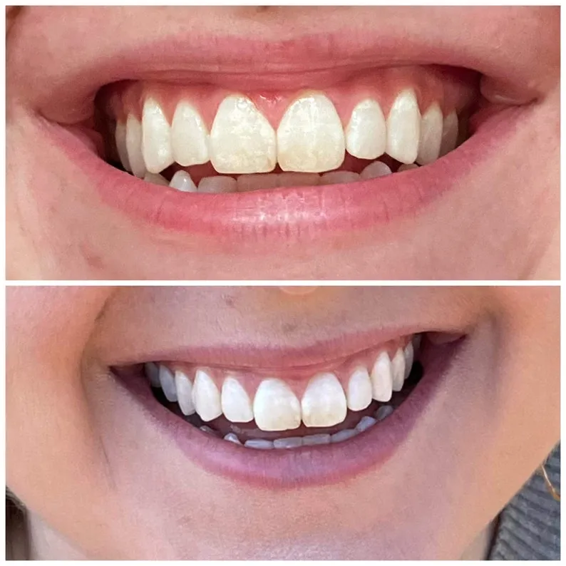 33710 nuskin whitening toothpaste comparison
