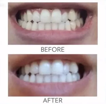 33710 nuskin whitening toothpaste ingredients