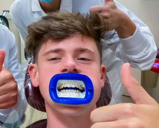 33723 in office teeth whitening