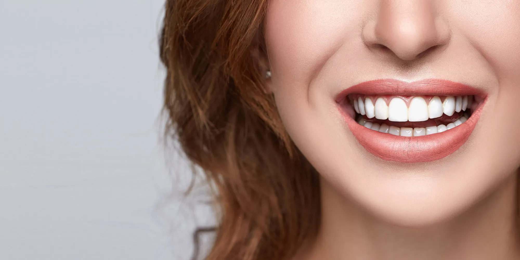 33723 types of teeth whitening