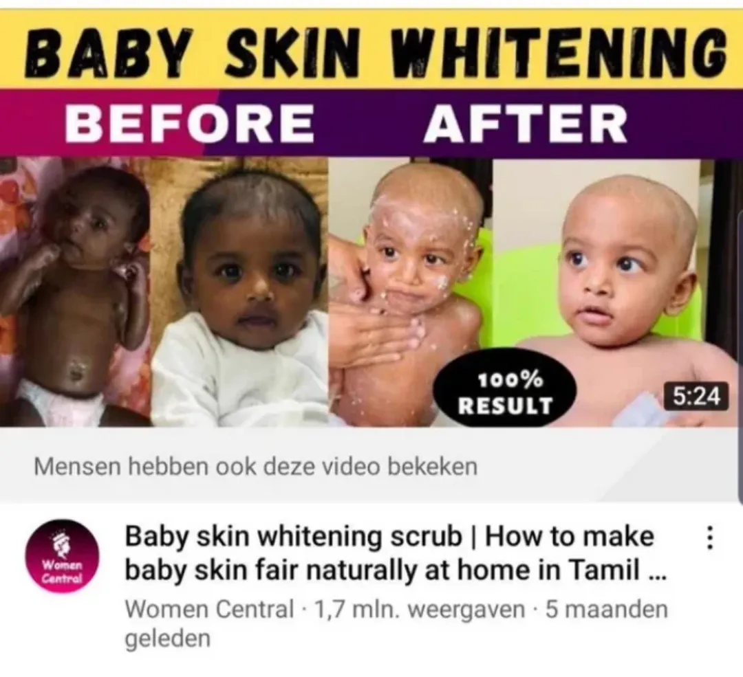 33727 professional teeth whitening