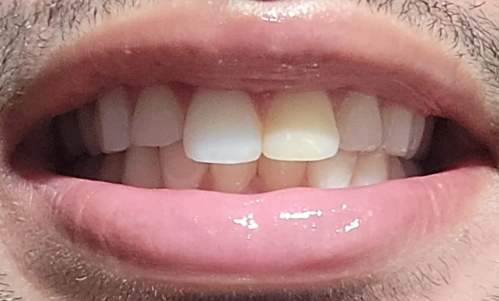 33727 whitening toothpaste