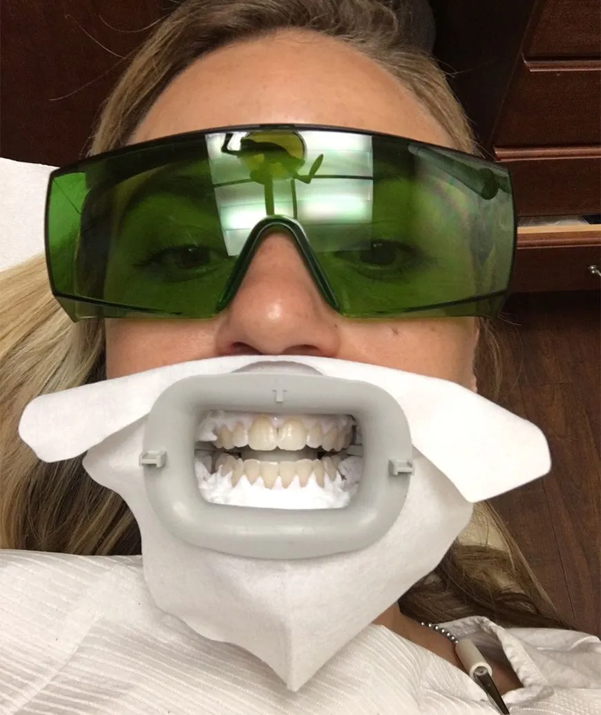 33731 sensitive teeth