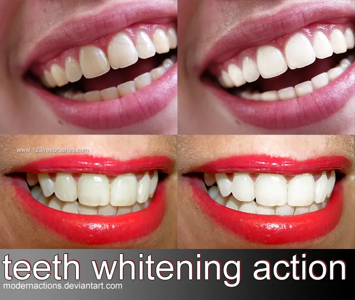 33734 avoid teeth staining foods